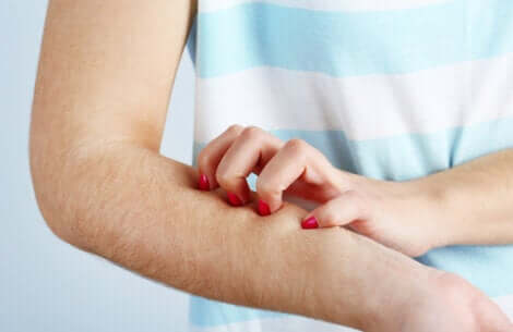 Femme en train de se gratter le bras