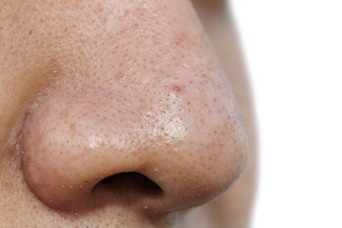 5 masques faciaux contre les points noirs 5 masques faciaux contre les points noirs