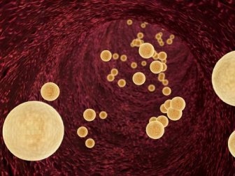 Comment diminuer les triglycérides de manière naturelle ?