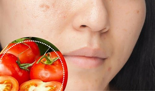 6 ingrédients naturels pour atténuer les taches du visage