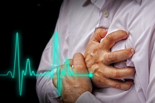 Ce qu'il faut savoir sur les palpitations