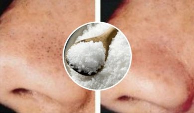 Comment utiliser le sel pour lutter contre les points noirs