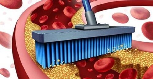 Artères obstruées : comment les déboucher ?