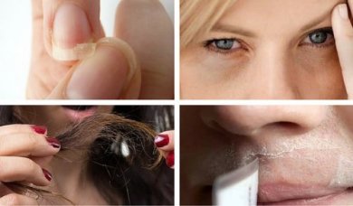 5 problèmes esthétiques communs qui pourraient avertir de quelque chose de grave