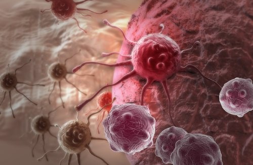12 variables psychologiques qui influent sur le cancer