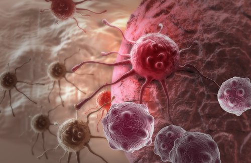 12 variables psychologiques qui influent sur le cancer 12 variables psychologiques qui influent sur le cancer