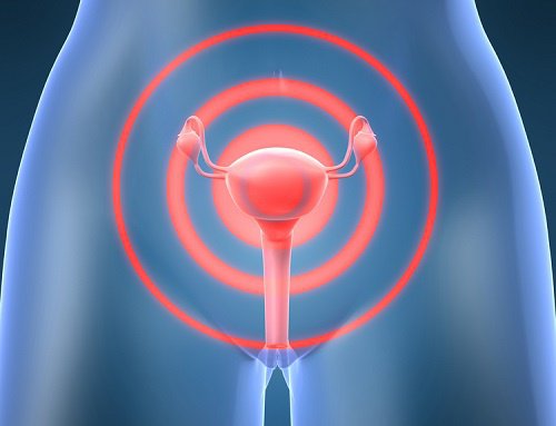 7 facteurs qui peuvent influer sur l'apparition du cancer du col de l'utérus