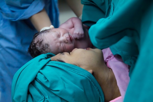 Les bébés nés par césarienne reçoivent un « bain » de bactéries vaginales Les bébés nés par césarienne reçoivent un « bain » de bactéries vaginales