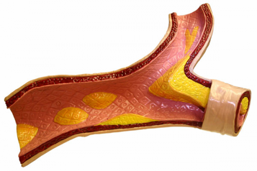 thé au jasmin contre le cholestérol