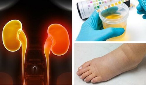 8 symptômes d'insuffisance rénale souvent ignorés