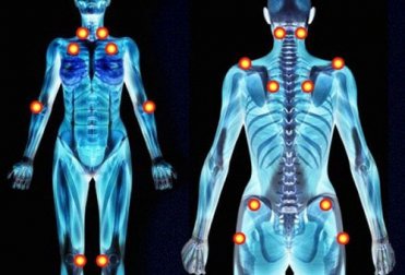 5 symptômes précoces de la fibromyalgie