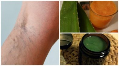 Soulagez les veines varices avec cette ancienne recette de grand-mère