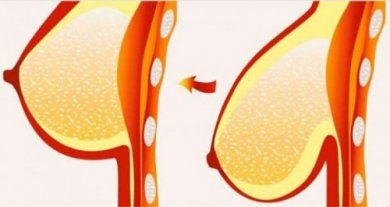 8 conseils pour lutter contre la chute des seins