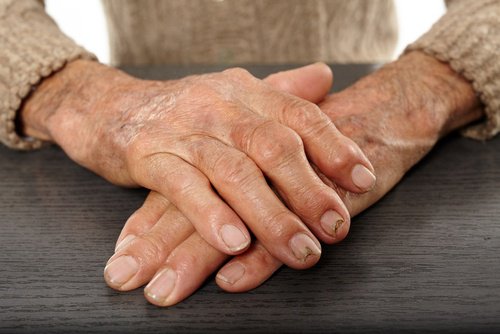 Soulage-l'arthrite-500x334
