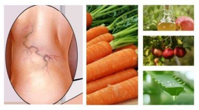 Traitement naturel contre les varices à l'aloe vera, à la carotte et au vinaigre de pomme
