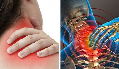 6 causes potentielles des douleurs au cou