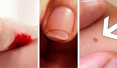 5 raisons surprenantes pour lesquelles vous devriez consulter votre dermatologue