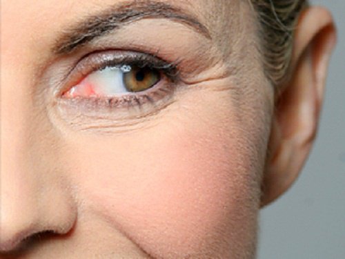 Du vinaigre pour les rides.