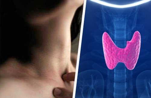 Comment détecter à temps une thyroïde qui fonctionne mal
