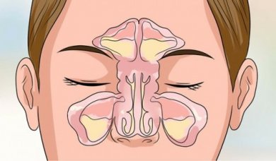 6 astuces pour déboucher le nez en quelques minutes