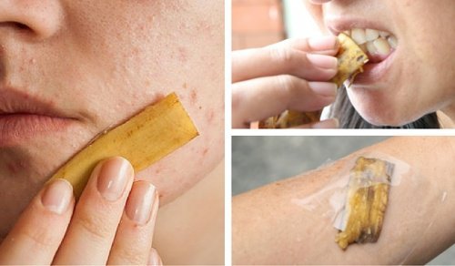 11 manières d'utiliser les peaux de banane
