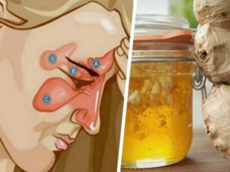 Deux ingrédients pour soulager la sinusite