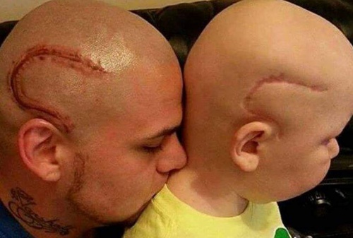 L'amour d'un père pour son fils opéré d'un cancer