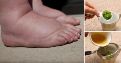 Un remède exceptionnel au persil pour soulager les pieds gonflés