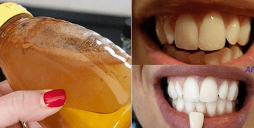 Blanchir vos dents avec un ingrédient 100% naturel