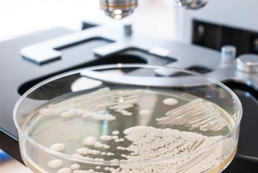 10 aliments qui vous aident à stopper le développement de la Candida