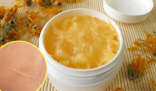 Crème naturelle pour diminuer la taille des cicatrices et les coupures