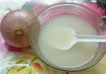 Éliminez les cors aux pieds avec ce remède à l'oignon et au vinaigre blanc