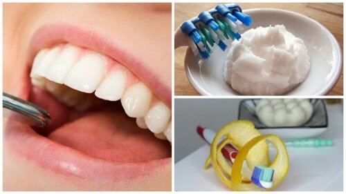 Le tartre sur les dents : 6 astuces pour l'éliminer
