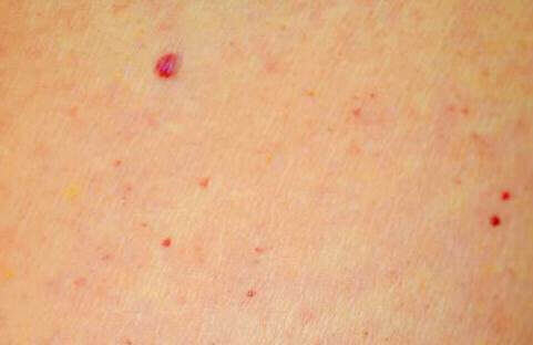 Des points rouges