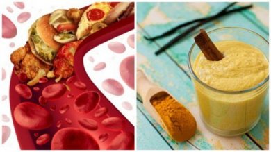 Les 5 meilleurs remèdes maison pour nettoyer les artères bouchées