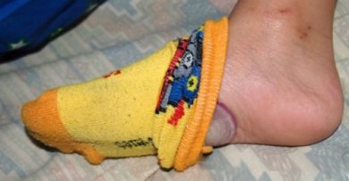 4 bienfaits de dormir avec un oignon sur les pieds chaque nuit