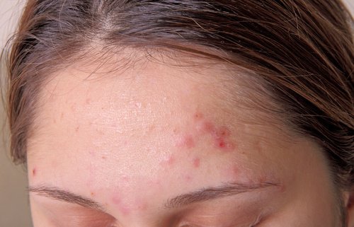 9 signes qui montrent que vous avez une surcharge de toxines