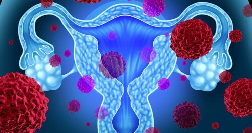Qu'est-ce que le syndrome du choc toxique associé aux tampons hygiéniques ?