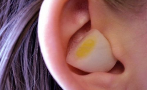 oreille-ail