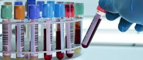 Une analyse de sang pour diagnostiquer la dépression