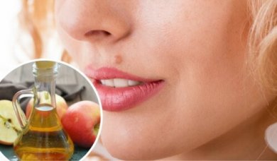 Des remèdes naturels pour éliminer les grains de beauté