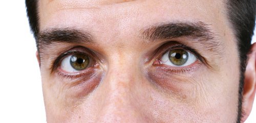 4 solutions naturelles pour en finir avec les cernes 4 solutions naturelles pour en finir avec les cernes