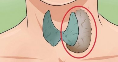 14 signaux qui vous indiquent un dysfonctionnement de la thyroïde
