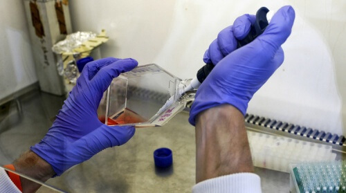 Donneur de moelle osseuse.