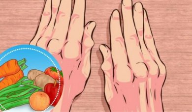 5 aliments simples à inclure dans le petit-déjeuner en cas d'arthrite