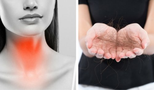 8 choses à faire pour lutter contre la chute des cheveux à cause de la thyroïde