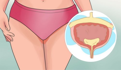 Ce que vous devez éviter si vous avez une vessie hyperactive