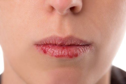 Symptômes du cancer oro-pharyngé à connaître
