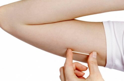 Tout ce que vous devez savoir sur les implants contraceptifs subdermiques