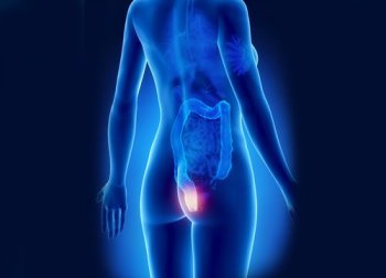 9 remèdes naturels contre les hémorroïdes